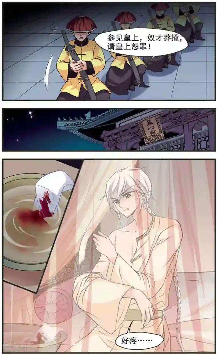妃夕妍雪第312话 意外受伤3