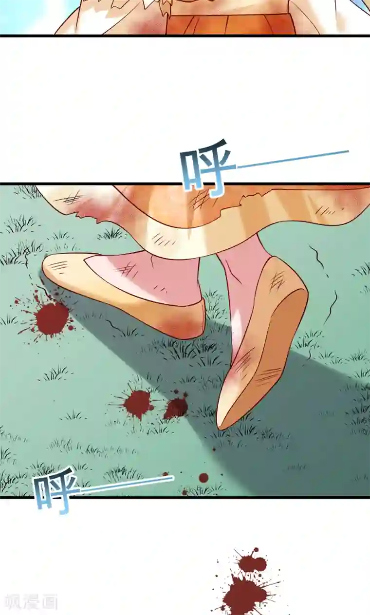 小皇书VS小皇叔第52话 触目惊心的伤痕