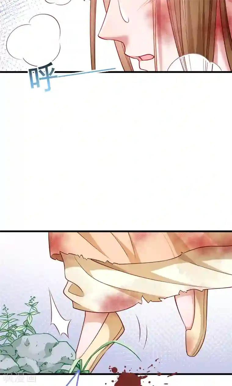 小皇书VS小皇叔第52话 触目惊心的伤痕