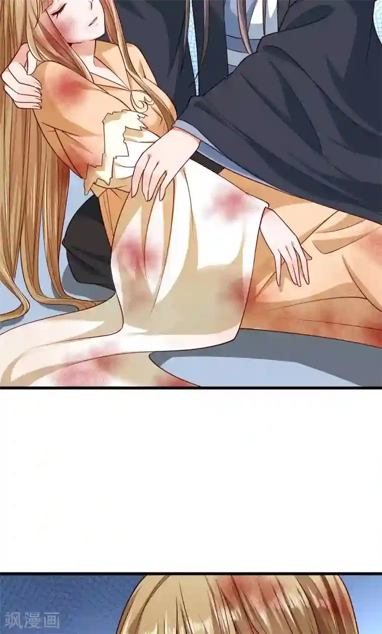 小皇书VS小皇叔第52话 触目惊心的伤痕