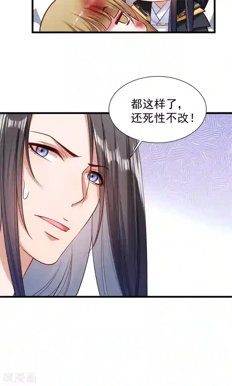 小皇书VS小皇叔第52话 触目惊心的伤痕