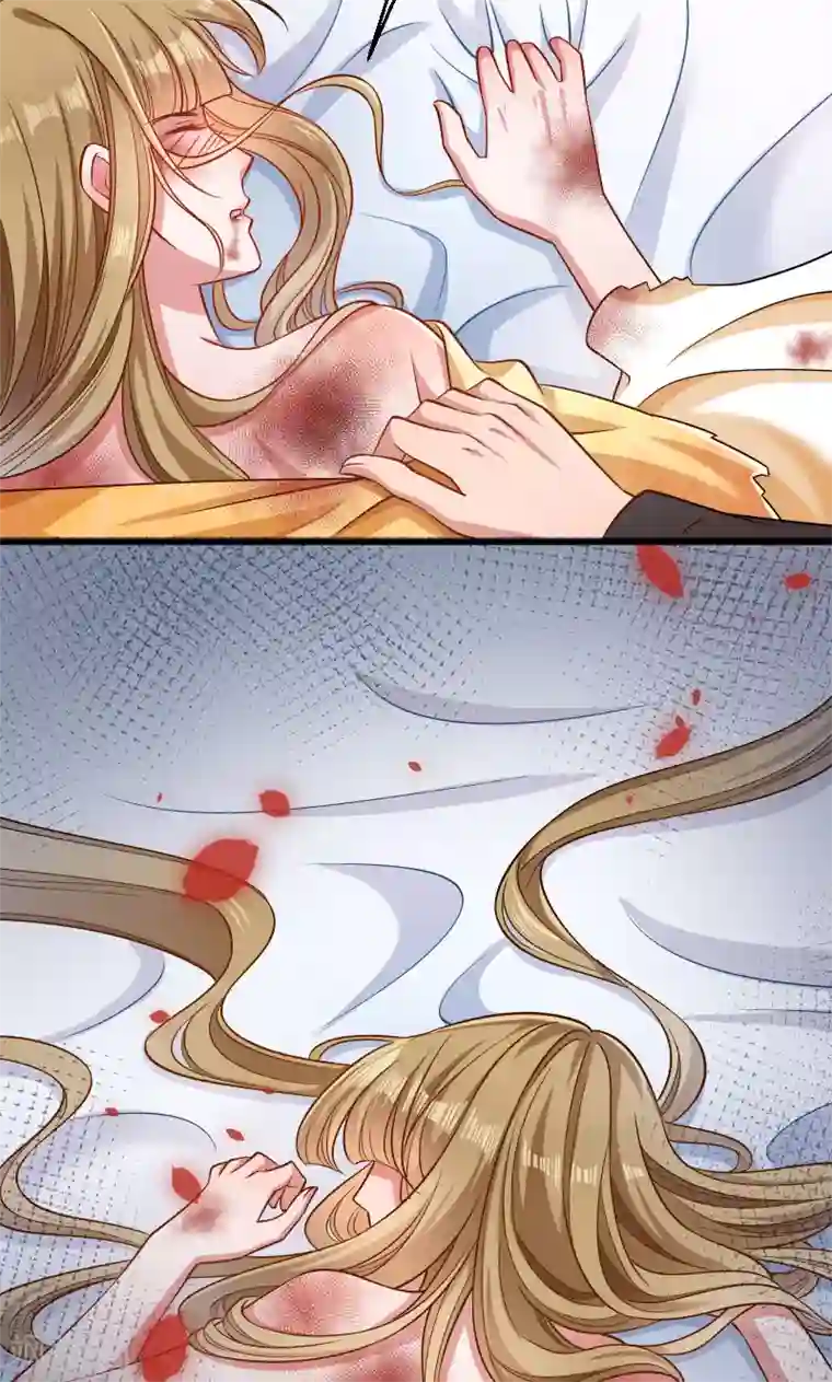 小皇书VS小皇叔第52话 触目惊心的伤痕