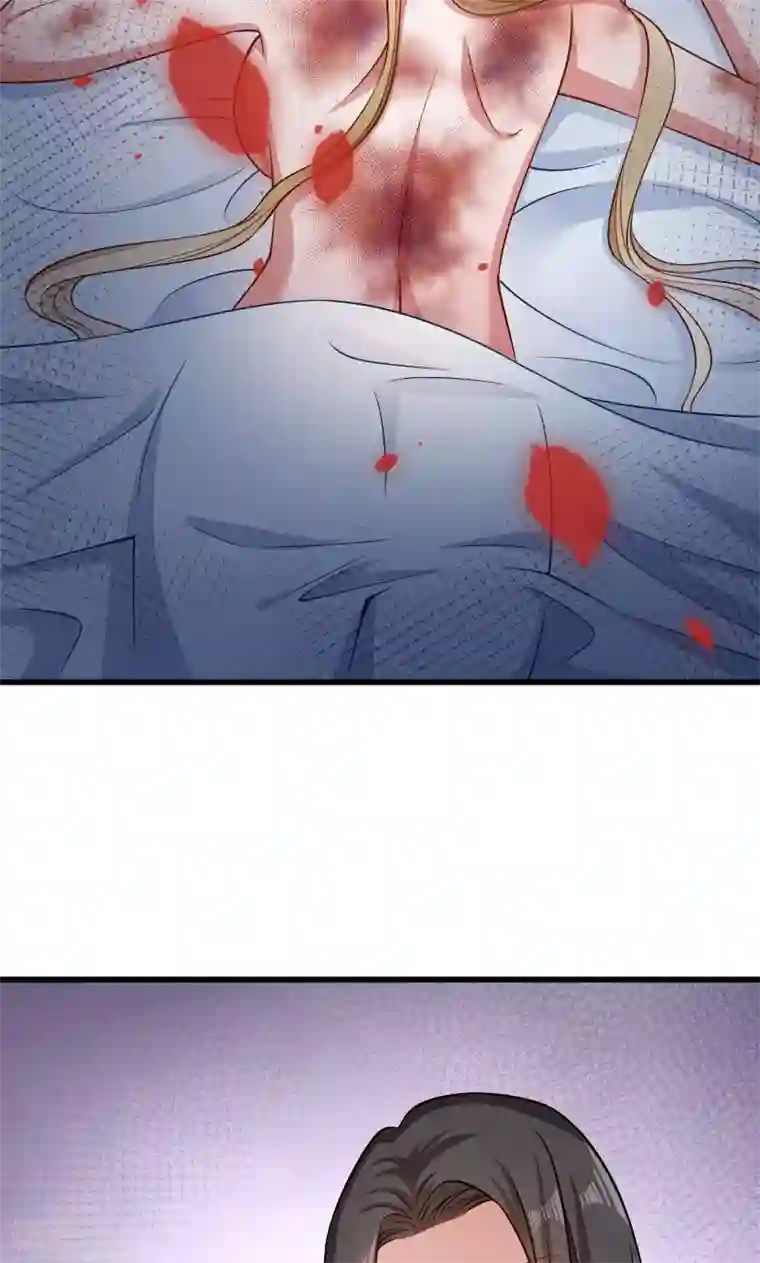 小皇书VS小皇叔第52话 触目惊心的伤痕