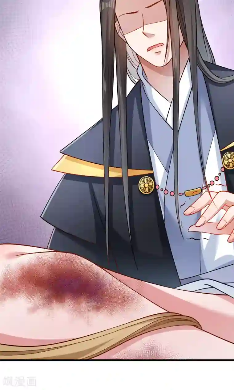 小皇书VS小皇叔第52话 触目惊心的伤痕