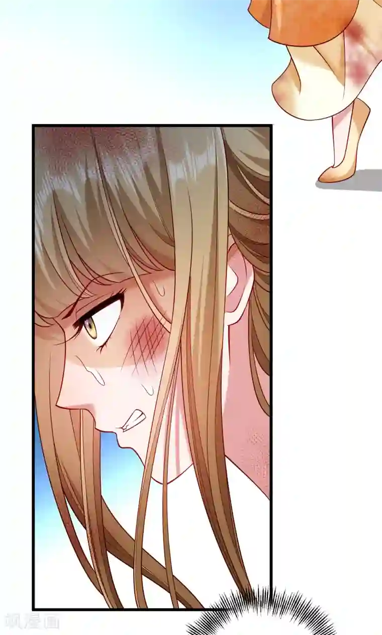 小皇书VS小皇叔第52话 触目惊心的伤痕