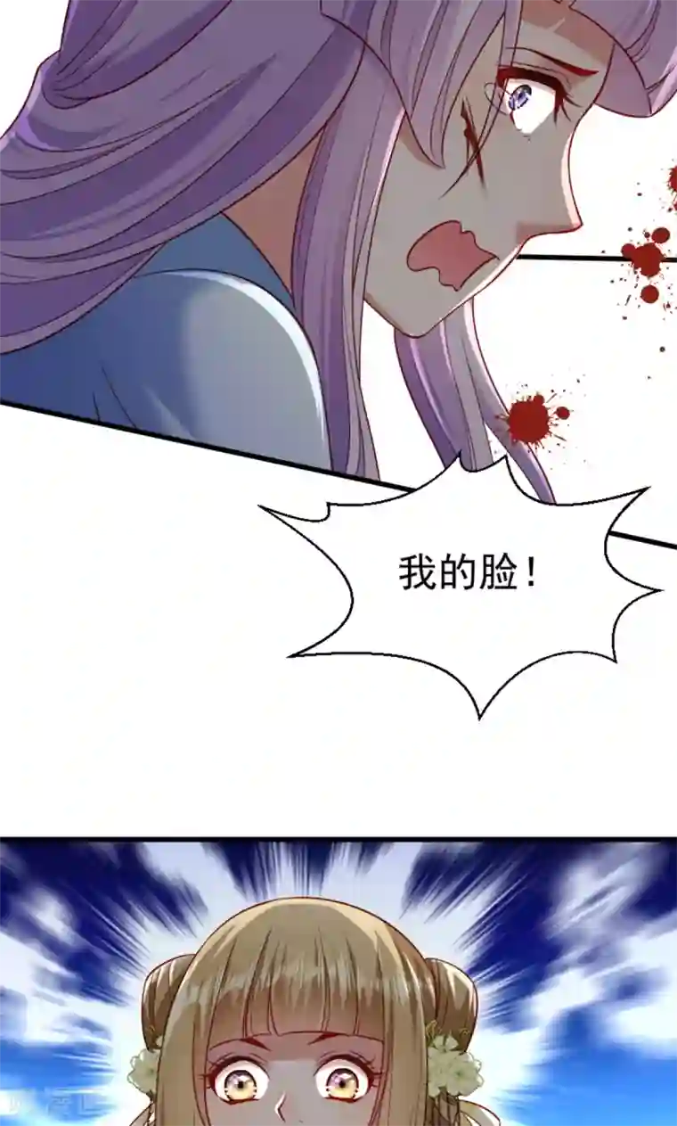 小皇书VS小皇叔第61话 璃美人毁容