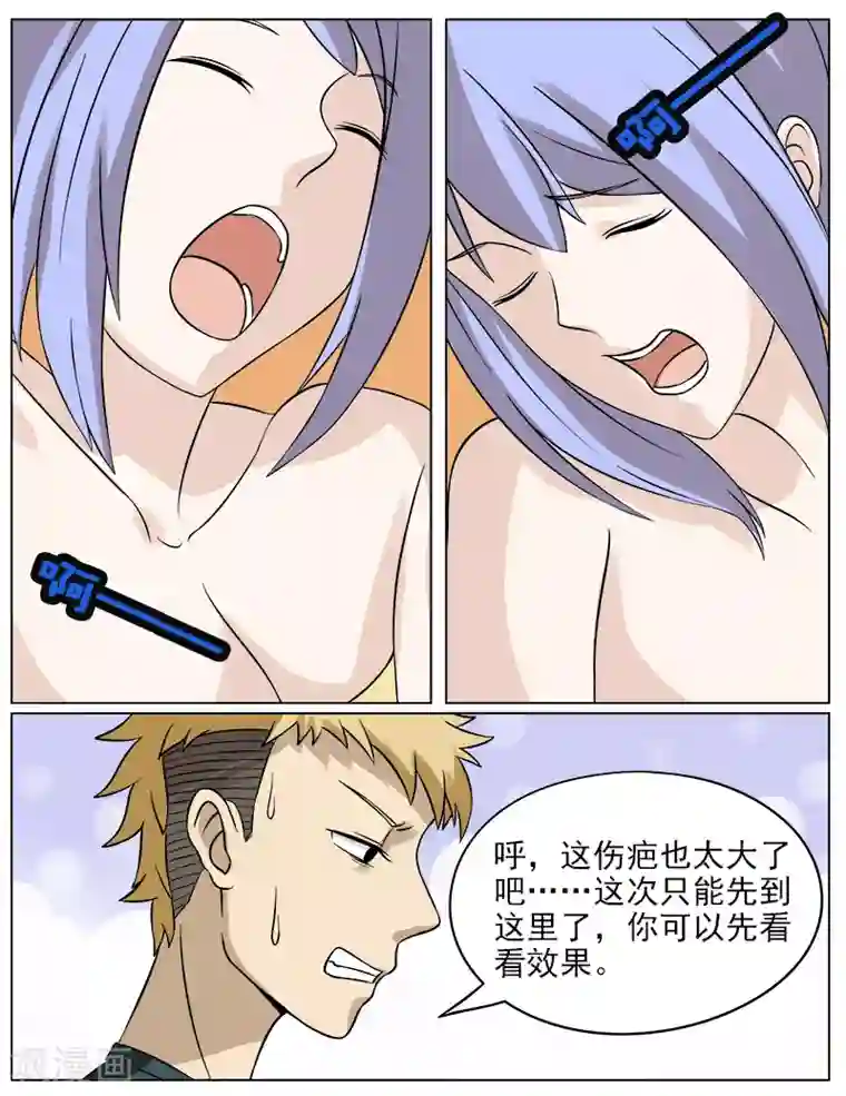 超能公寓第28话 治疗伤疤