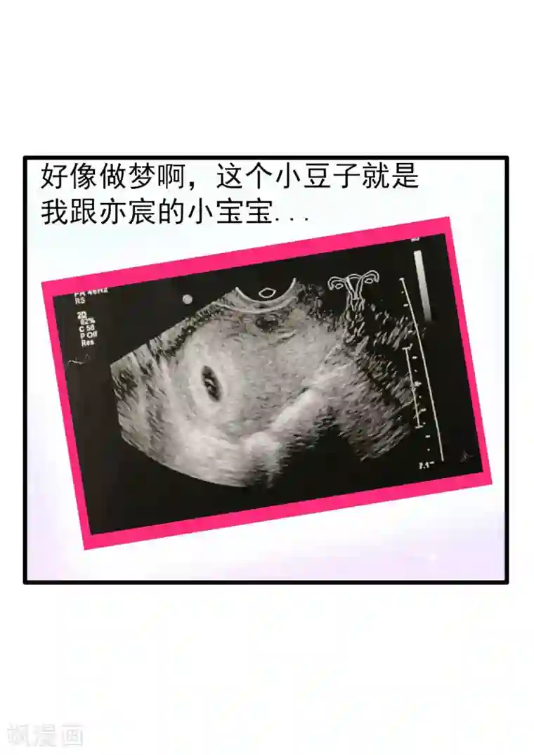 冰山总裁的冒牌新娘第88话 就叫他小豆子吧！