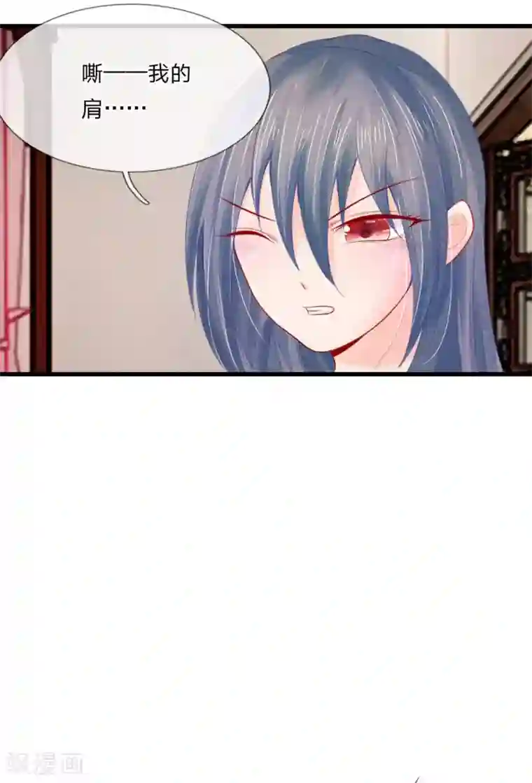 医妃权倾天下第31话 腿伤复发