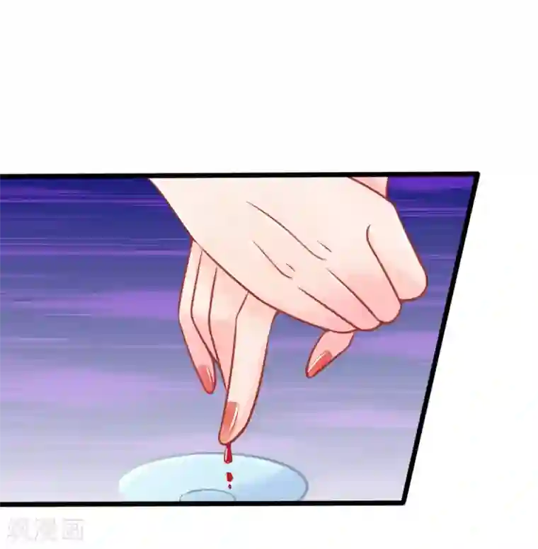 医妃权倾天下第52话 只剩几年寿命