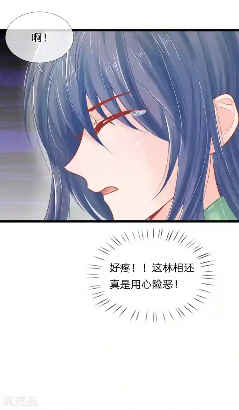 医妃权倾天下第82话 保命要紧