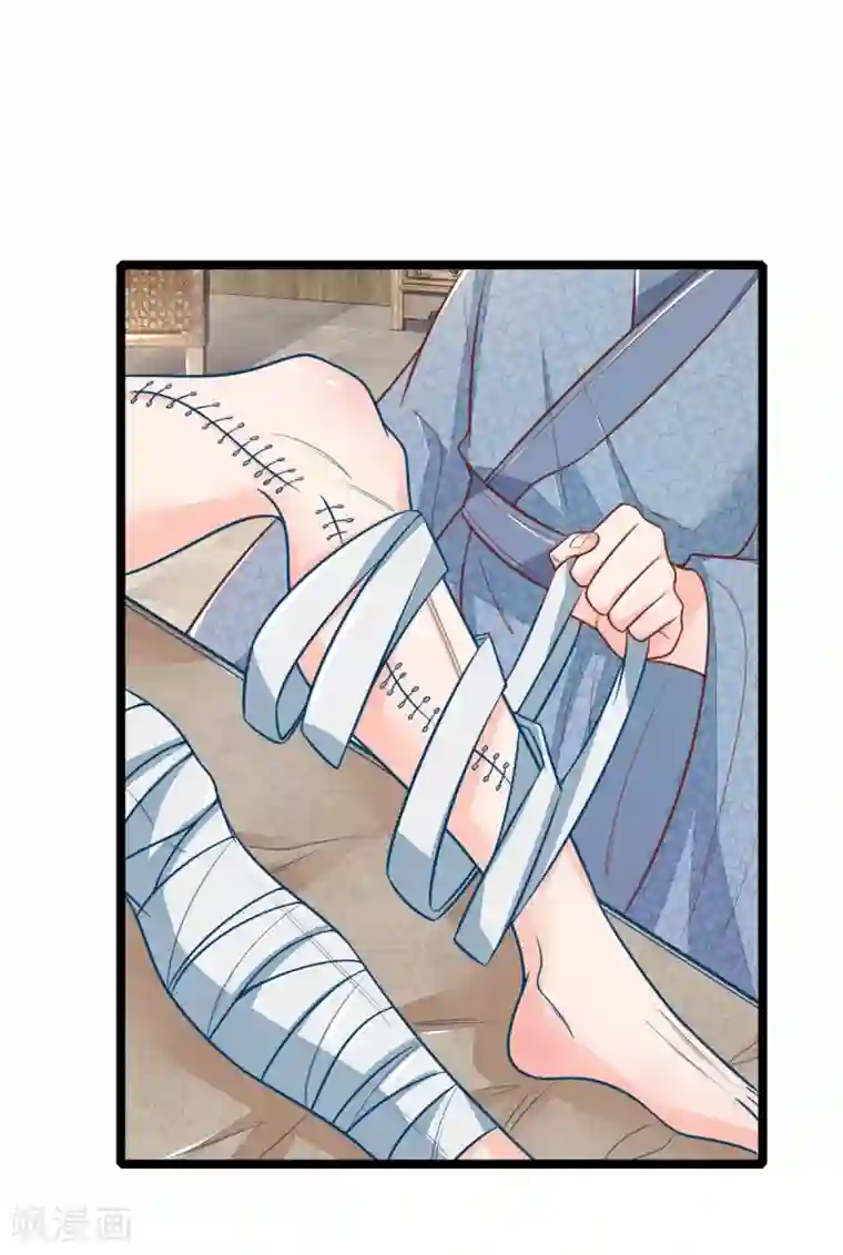 医妃权倾天下第111话 王爷不听话