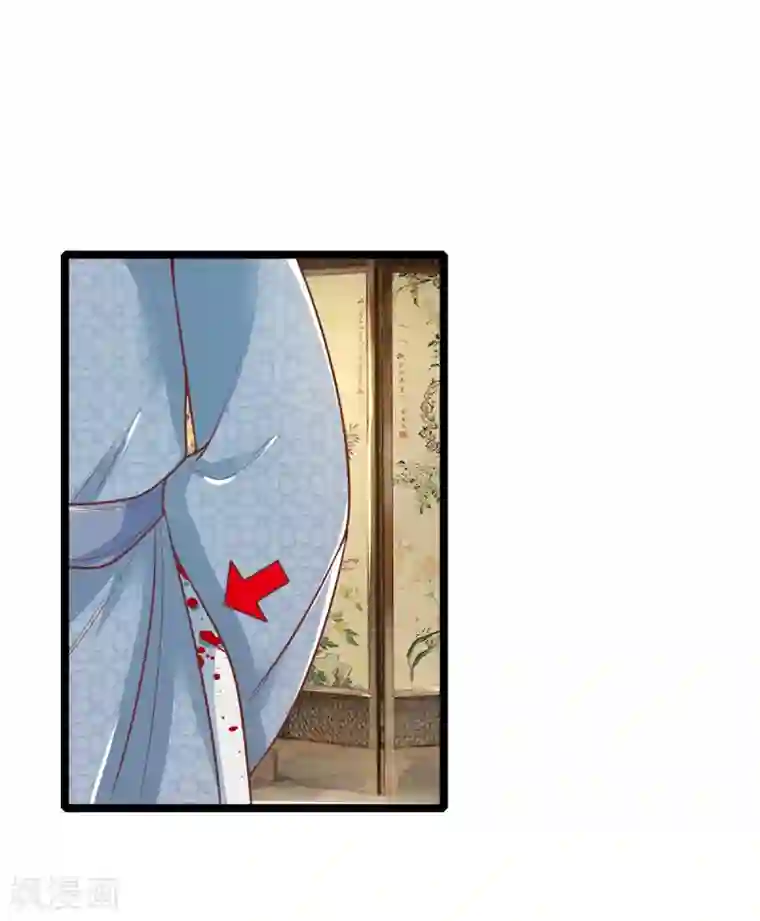 医妃权倾天下第112话 指桑骂槐