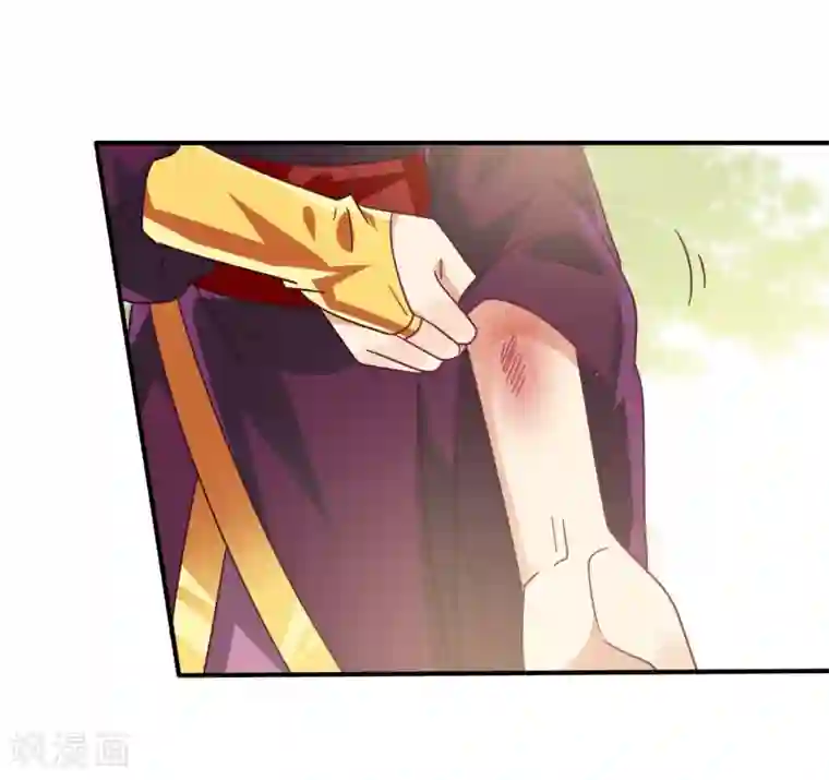 兽宠女皇第32话 论受伤后的区别对待