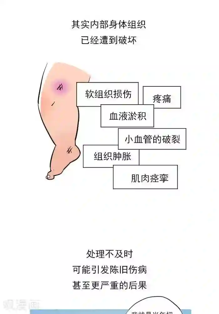 大牛健身漫画第15话 急性损伤怎么应急处理？