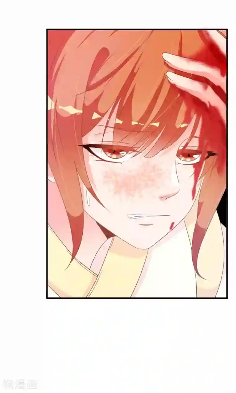 满朝文武嫉恨我第29话 毁容才能逃过一劫