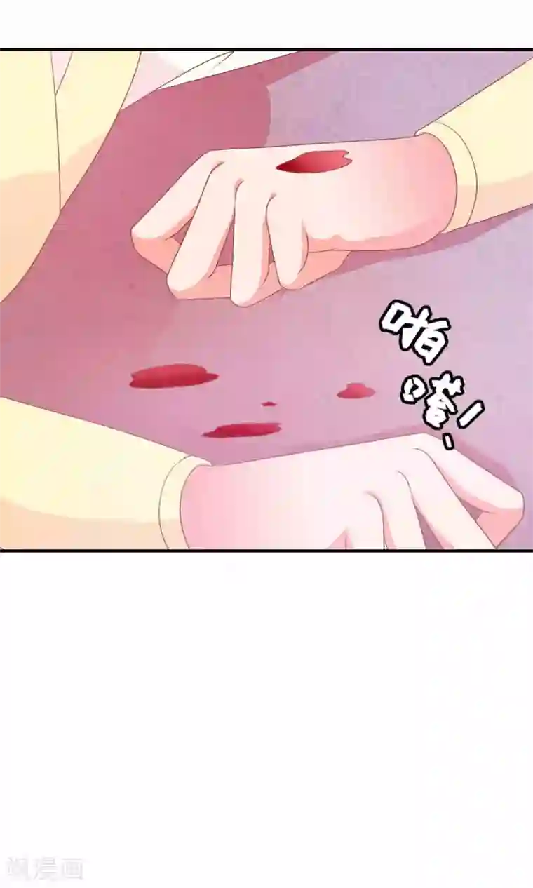 满朝文武嫉恨我第29话 毁容才能逃过一劫