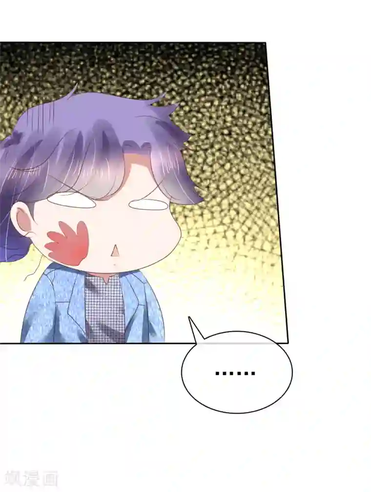 因爱宠你第151话