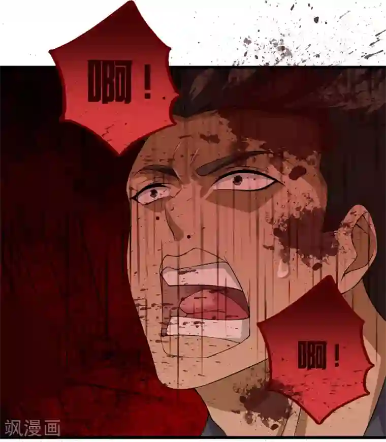 都市至尊第22话 断腿