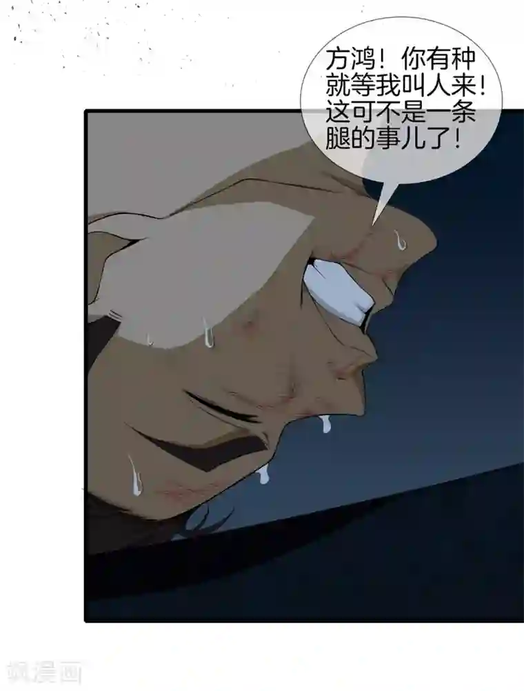 都市至尊第22话 断腿