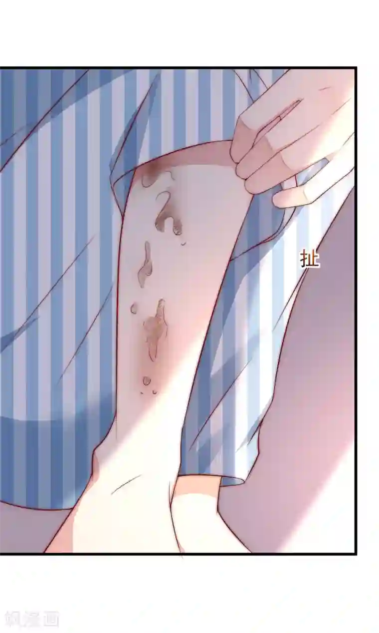 渣男总裁别想逃第147话 我曾经被渣男伤害过