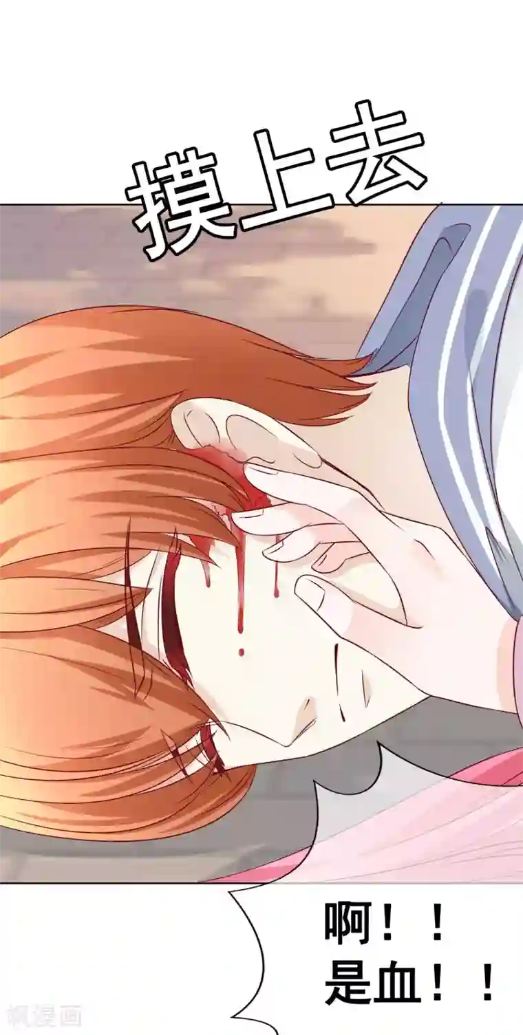 我的童颜大龄女友第52话 重伤1