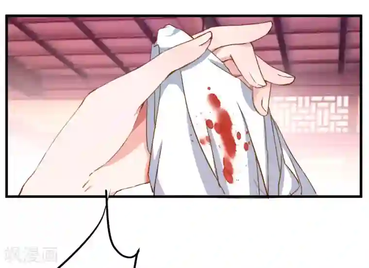 倾世医妃要休夫第6话 展露医术