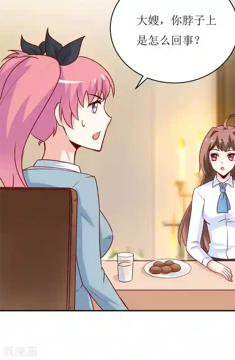 嗜血老公：错嫁新娘休想逃第75话 被狗咬的