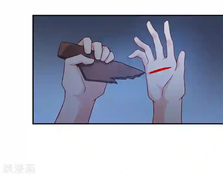 嗜血老公：错嫁新娘休想逃第119话 条件