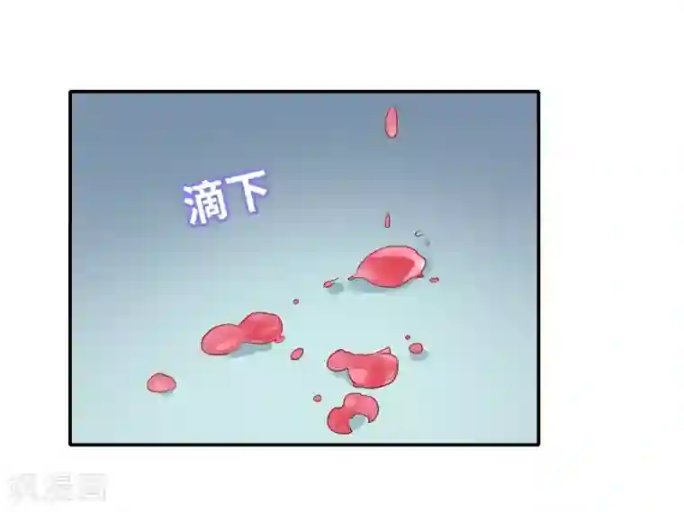 恋爱超速第2话 受伤了要舔一舔~