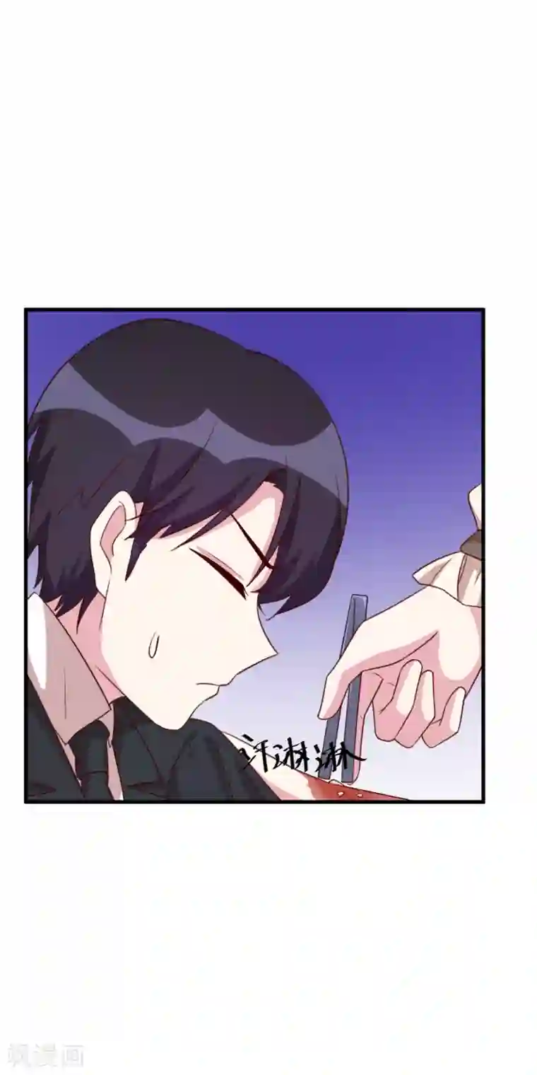 撒旦总裁惹不起第49话 给总裁包扎