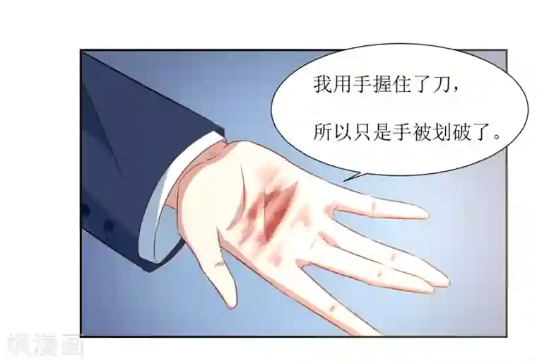 恶魔爱上小猫咪第57话 受伤了