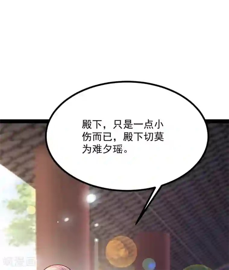 读心狂妃倾天下第84话 你需要本王