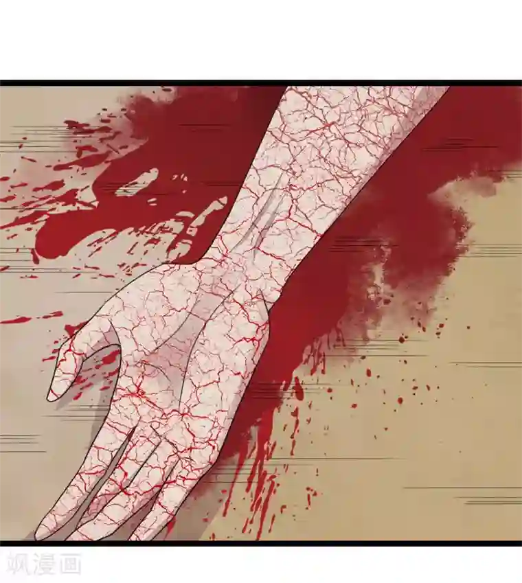 双面鬼王缠上我第19话 尸斑消失了