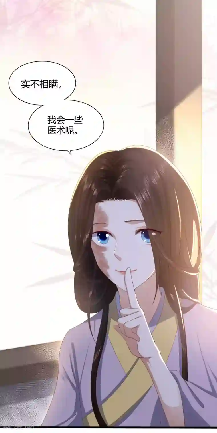 凤凰错:专宠弃妃第2话 初露医术