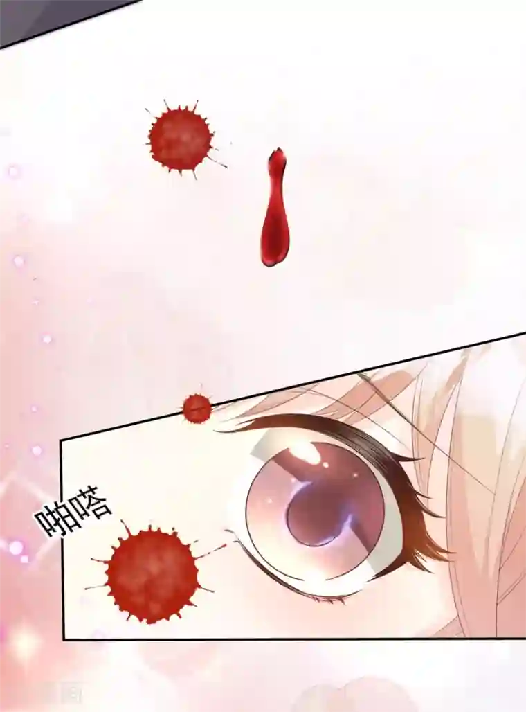 独家宠爱：我的甜心宝贝第44话 谁也不能伤害我的女人