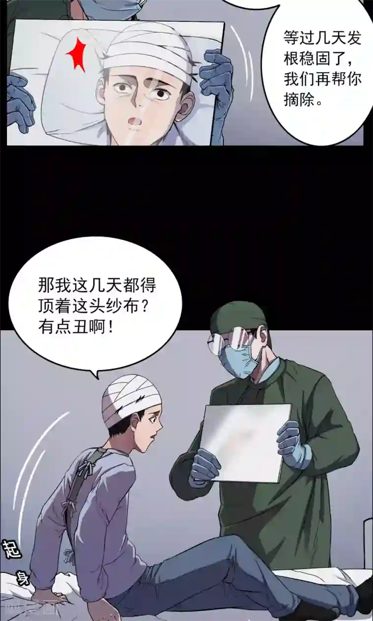 密集黑洞第17话 植发2