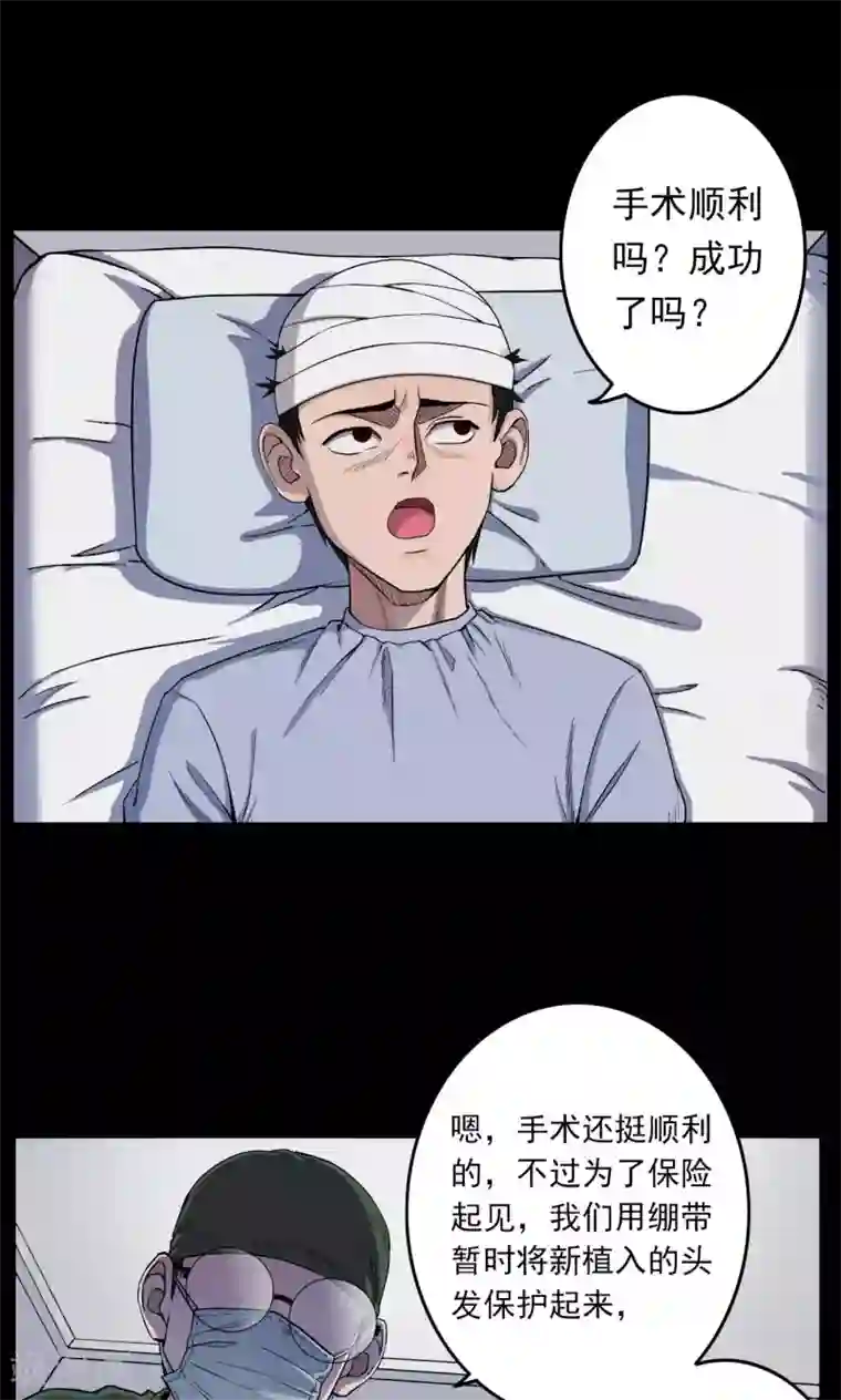 密集黑洞第17话 植发2