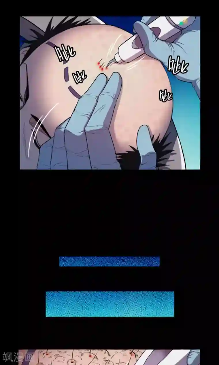 密集黑洞第18话 植发3