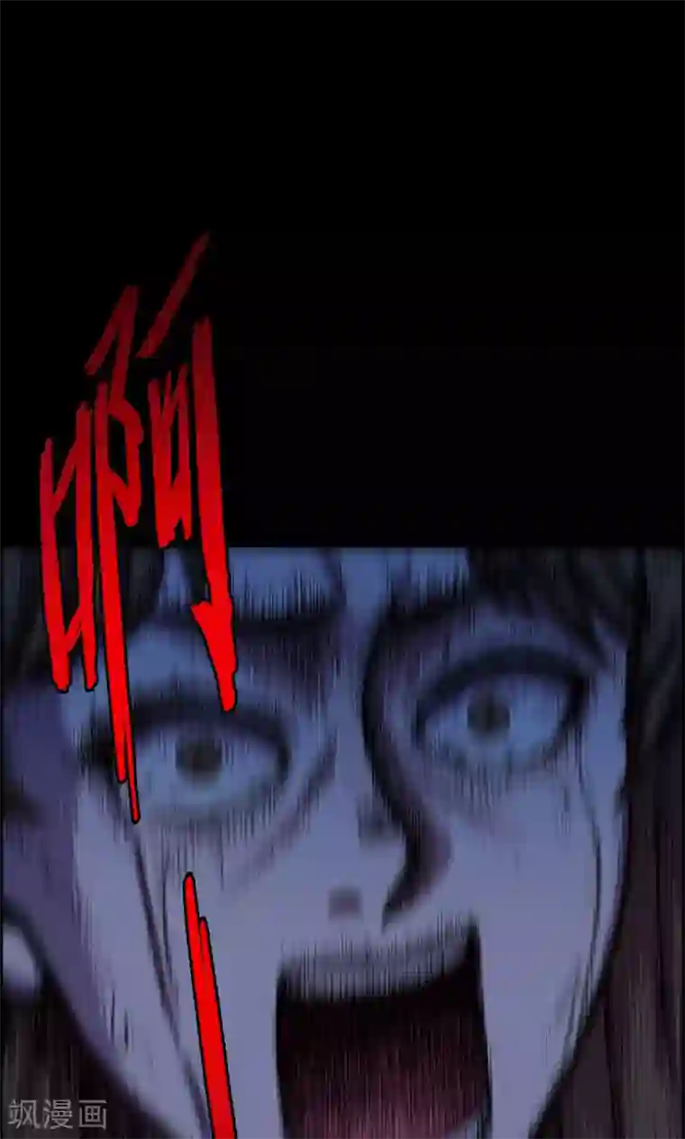 密集黑洞第19话 植发4