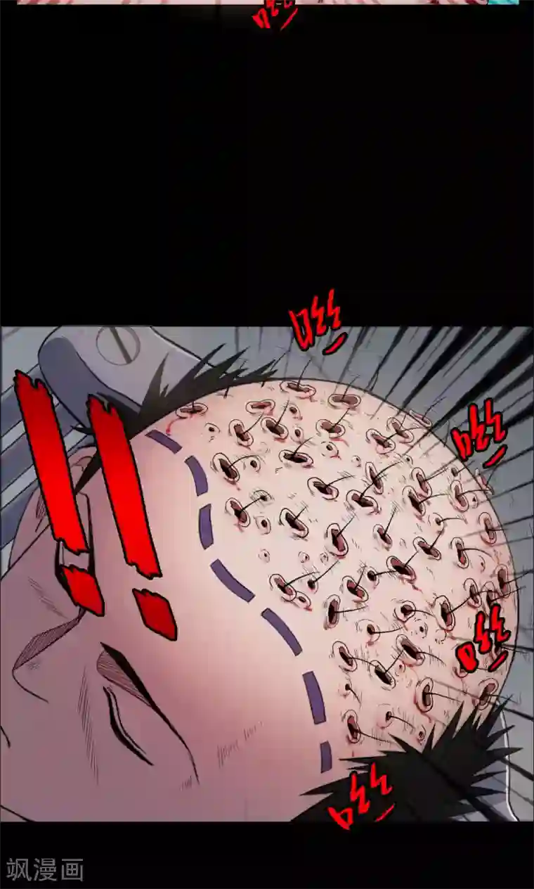 密集黑洞第19话 植发4