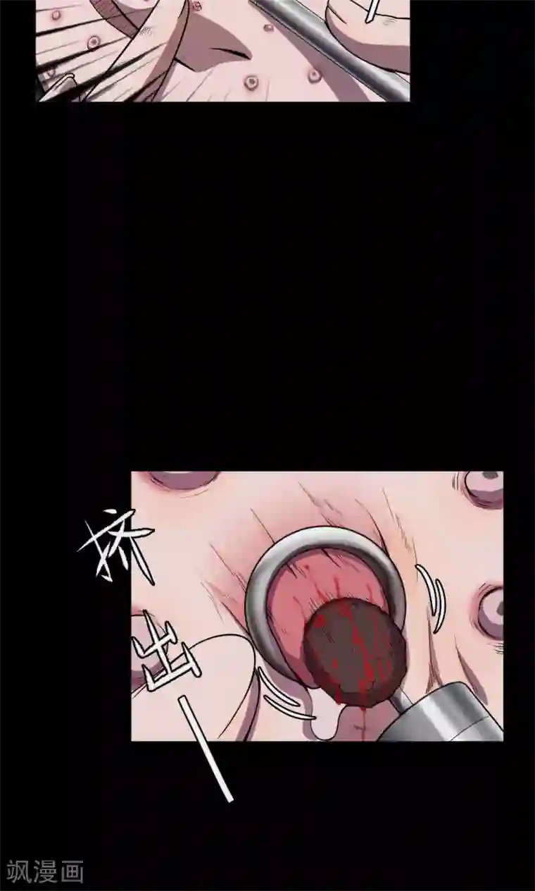 密集黑洞第63话 药丸2