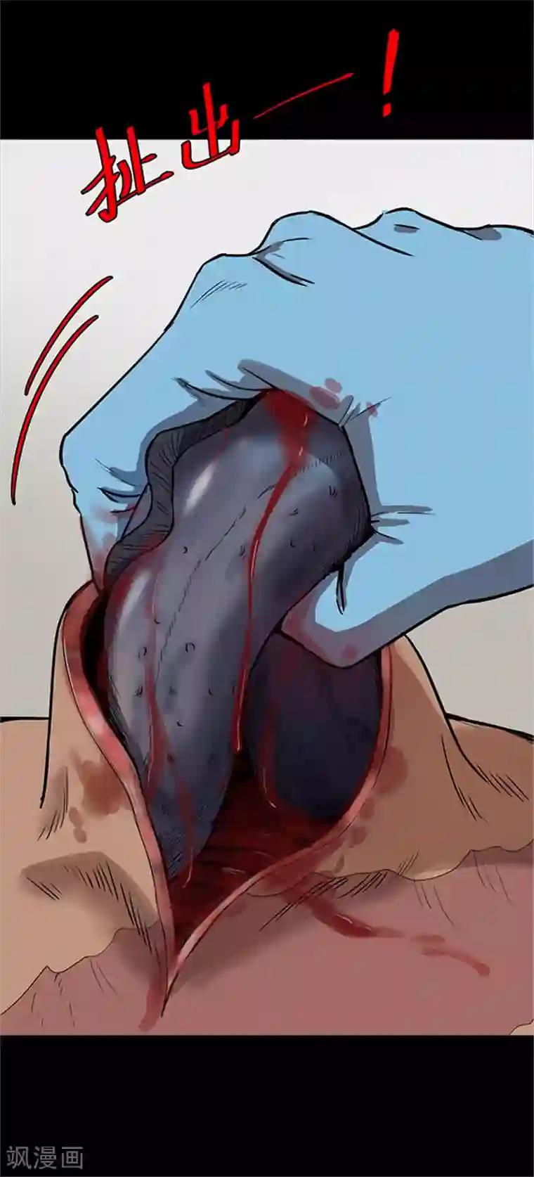 密集黑洞第107话 拳击2