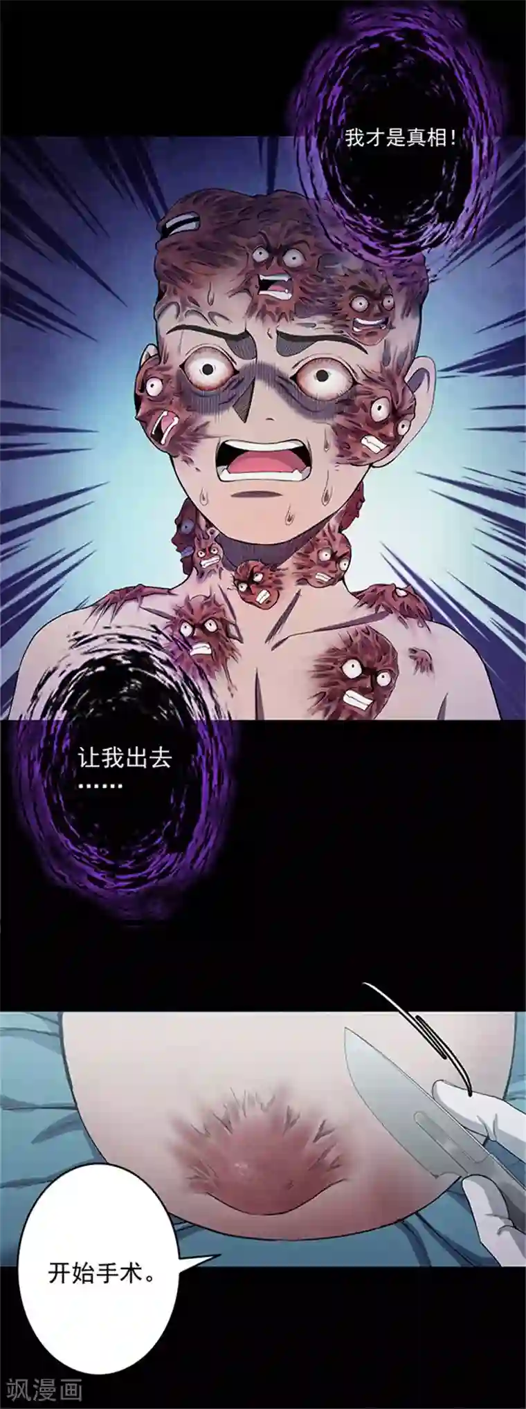 密集黑洞第141话 人面瘤