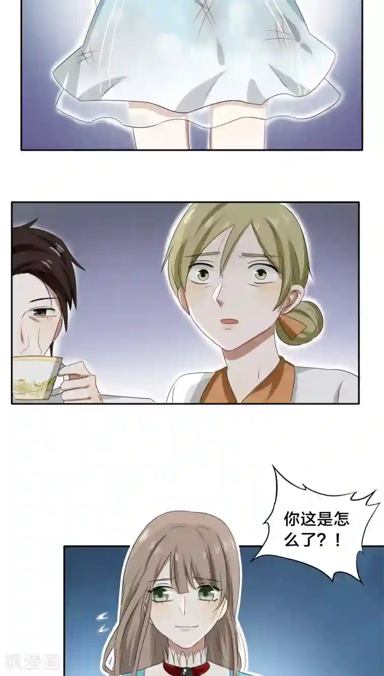 帝少掠爱成瘾第30话 没事，在工地摔了一跤