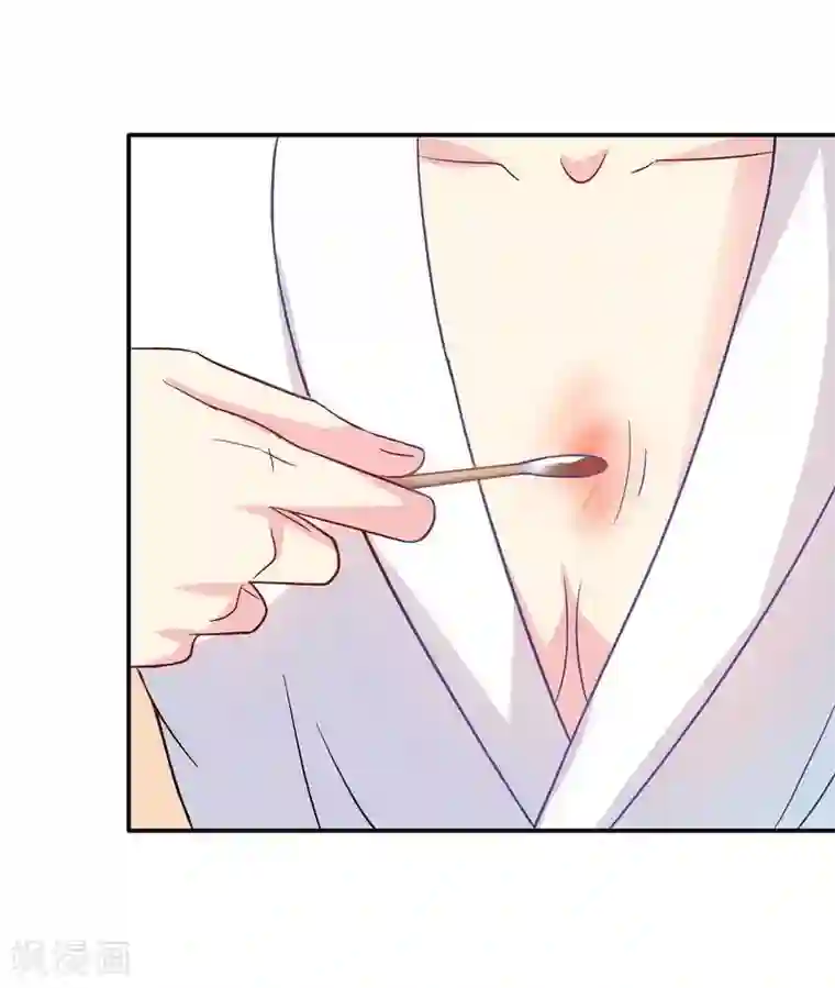 雪色撩人第46话 擦药