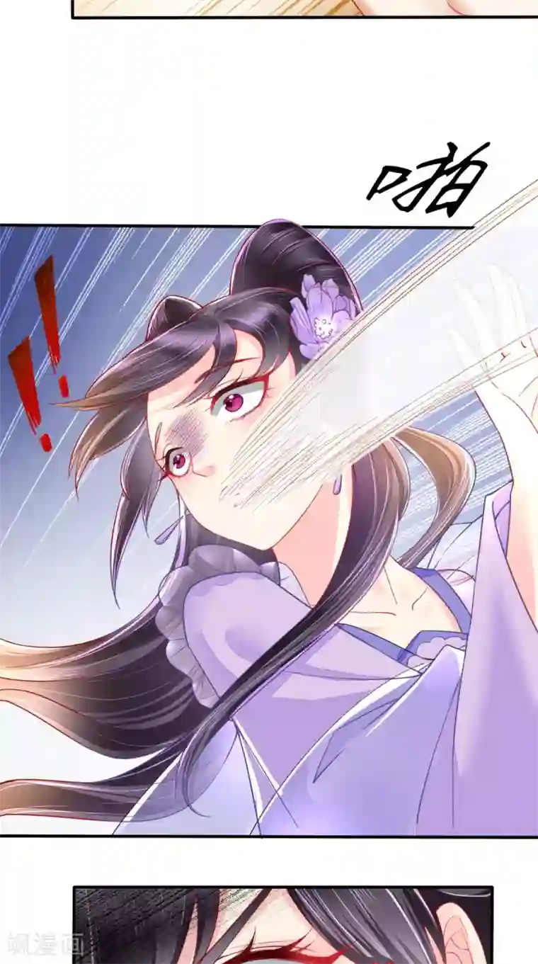 痴傻毒妃不好惹第11话 咱们来日方长！