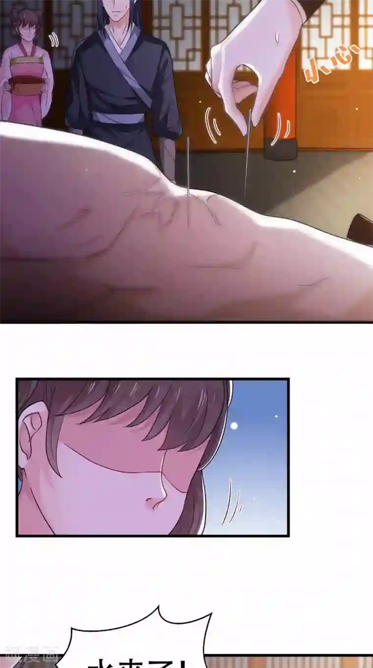 盛世女医：冷王宠妃第44话 一盆水