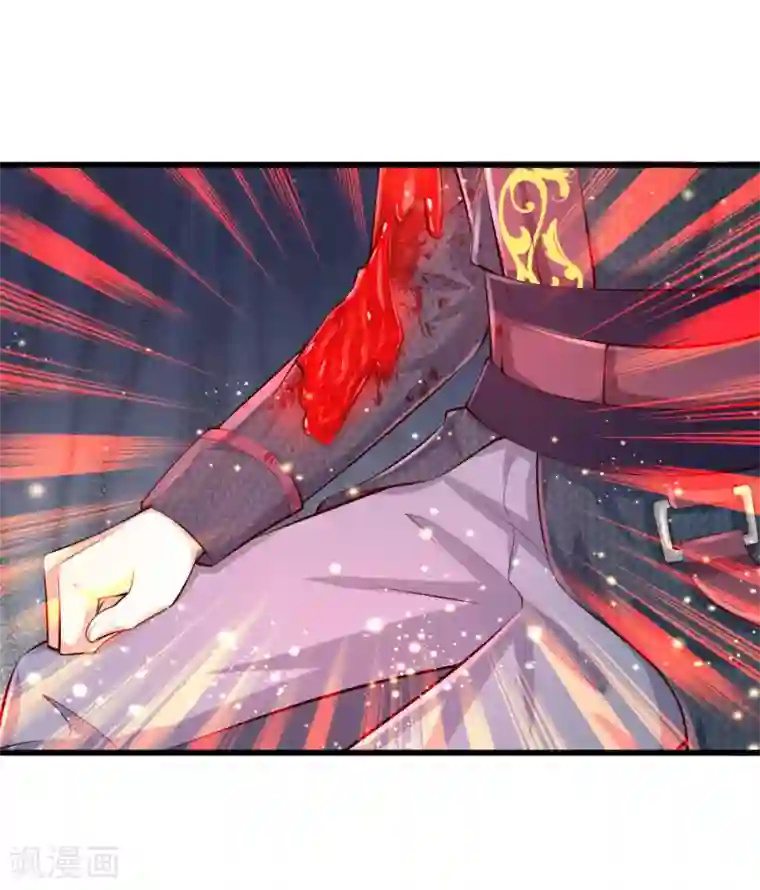 某天成为王的女儿第127话 受伤了