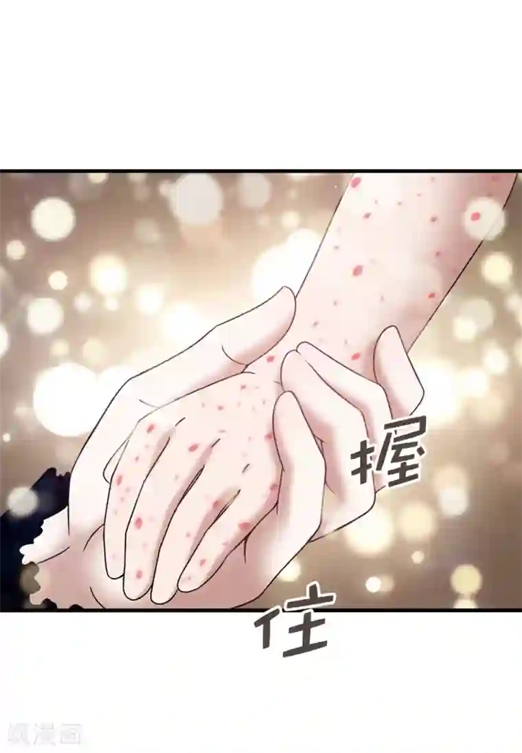 我不是女神第124话 疾病转移